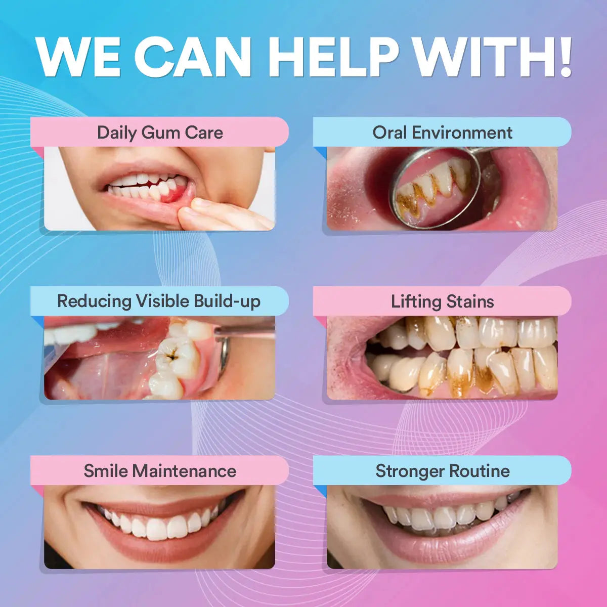 Ultrasonic Tooth Cleaner *BEST SELLER* Soya Confort